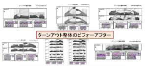 ターンアウト整体のビフォーアフター